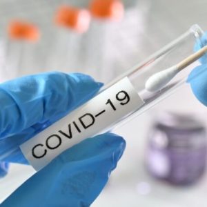 Covid-19 Testing Kit